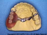 SSD-SUPPLY Strength Denture