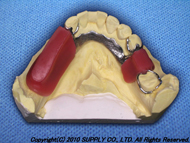 SSD-SUPPLY Strength Denture